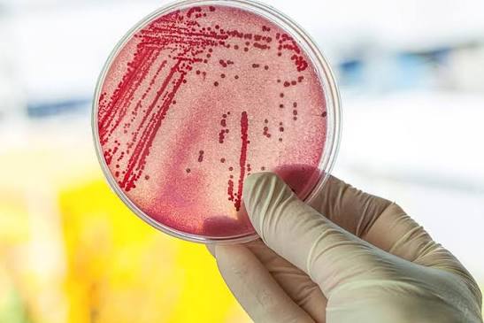 COLIFORMS TRONG NƯỚC UỐNG