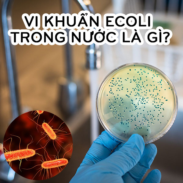coli trong nước uống